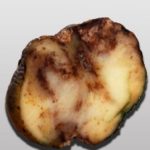 Late blight