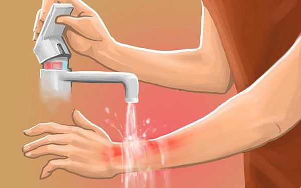 Εάν το πιπεριά καίει, ξεπλύνετε την περιοχή με άφθονο νερό.