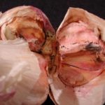 The defeat of the head of garlic